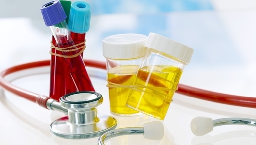 Tổng hợp về các xét nghiệm máu và nước tiểu Tổng hợp về các xét nghiệm máu và nước tiểu