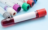 Lịch xét nghiệm cho người trên 40 tuổi và cách đọc kết quả Lịch xét nghiệm cho người trên 40 tuổi và cách đọc kết quả